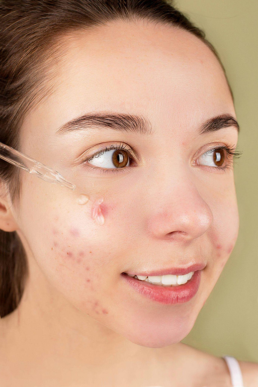 Here is Why You Need To Add Niacinamide To Your Skincare Routine-Image 4